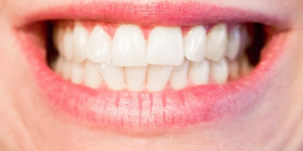 TMD can be treated with oral appliance therapy