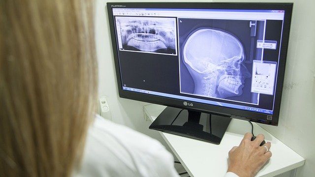 Understanding the uniqueness of temporomandibular disorder